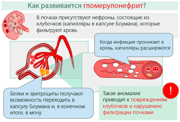 Скарлатина у ребёнка