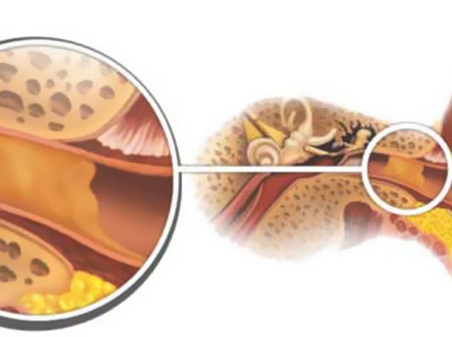 Как человеку хорошо почистить уши в домашних условиях