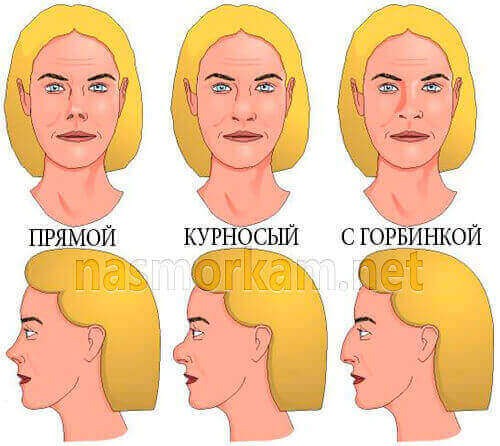 Кривой нос - способы исправить дефект