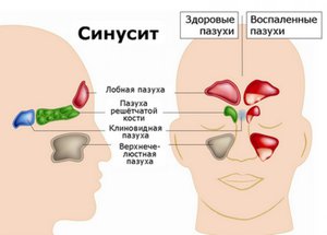 Как применять капли в нос с Фенилэфрином