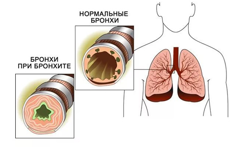 Гелисал инструкция по применению