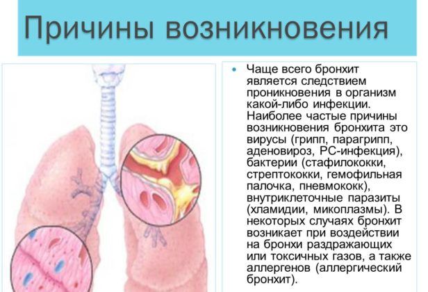 Лечение и профилактика воспаления бронхов