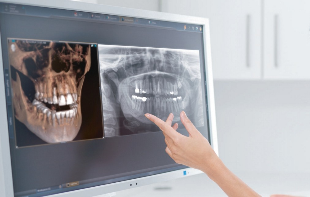 Компьютерная томография зубов: современный метод диагностики и планирования лечения