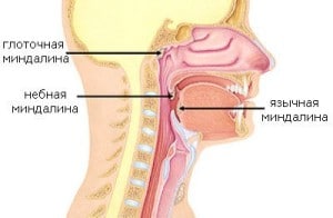 Лечение гипертрофии язычной миндалины