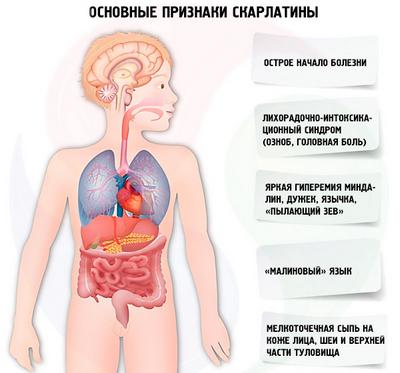 Скарлатина – возможная причина тяжёлого дыхания