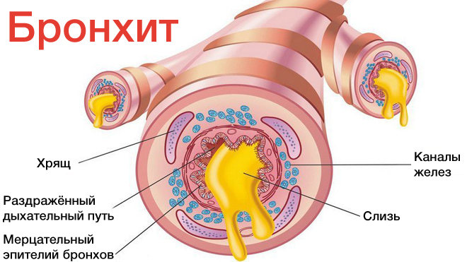 Возможные осложнения после гайморита