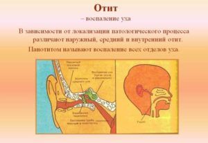Заложило ухо после простуды что же делать