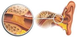 Ухо болит, заложено и плохо слышит причины и варианты лечения