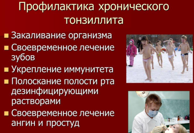 Чем опасен хронический тонзиллит основные симптомы и причины развития болезни