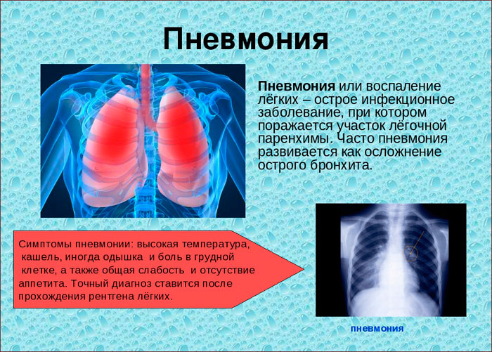 Лучшие препараты для выведения мокроты у детей