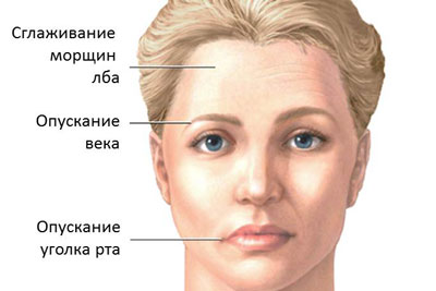 Причины лабиринтита и методы его лечения