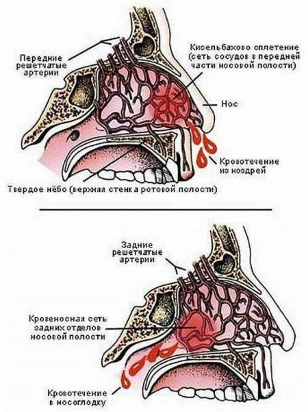 Кровь из носа при беременности третий триместр