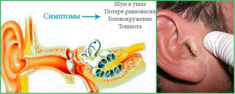 Заболевания ушей человека