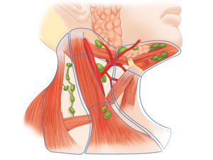 Подчелюстные лимфоузлы причины воспаления и лечение