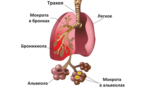 Экстракт плюща разжижает мокроту, облегчая отхаркивание и способствуя более быстрому выздоровлению