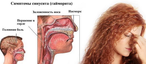 Капли в нос с антибиотиком