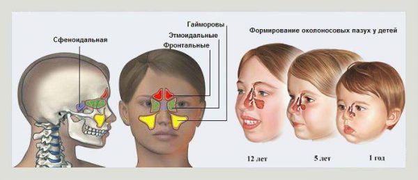 Чем лечить насморк у ребенка все что нужно знать