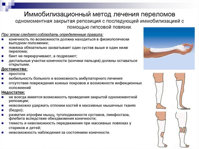 Методы и особенности репозиции костных отломков