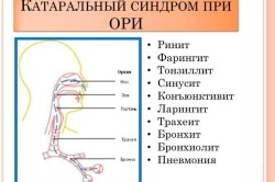 Какие признаки и как лечить катаральный синусит