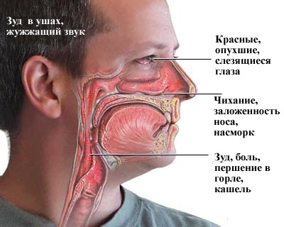 Причины и лечение осиплого голоса у ребенка на дому