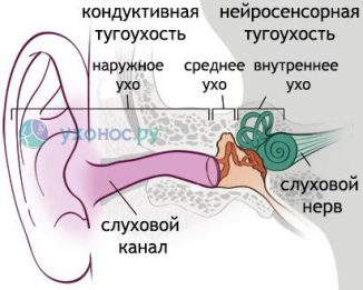 тугоухость код по МКБ-10