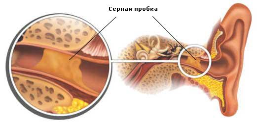 Булькает в ухе, но не болит