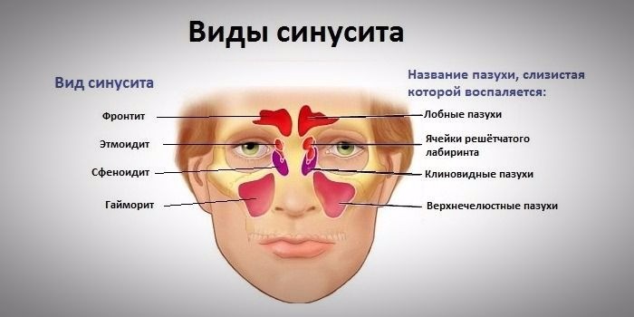 Лечение ЛОР-заболеваний