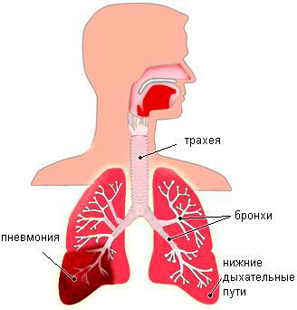 Мокрота с кровью при кашле