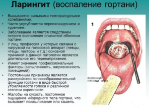 Облепиховое масло применяется при ларингите