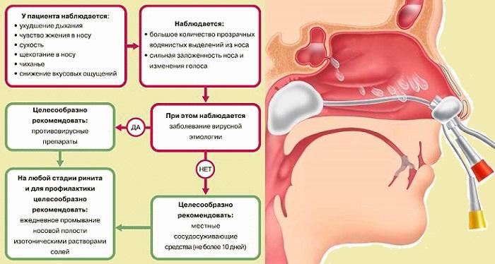 Лечение затяжного насморка у взрослого человека