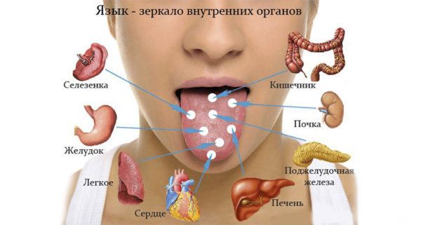 Налет на задней стенке глотки