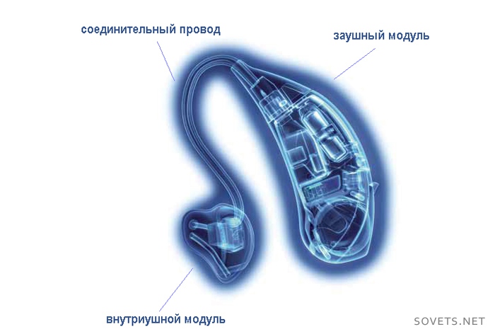 Слуховые аппараты для пожилых людей виды, советы по выбору