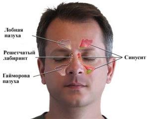 патологическим заболеванием,киста