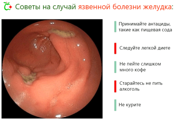 Что делать, если при кашле болит правый бок под ребрами