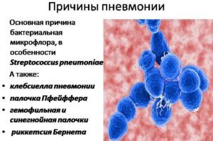 Особенности бронхиальной пневмонии у детей