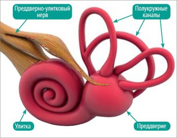 Сенсоневральная тугоухость